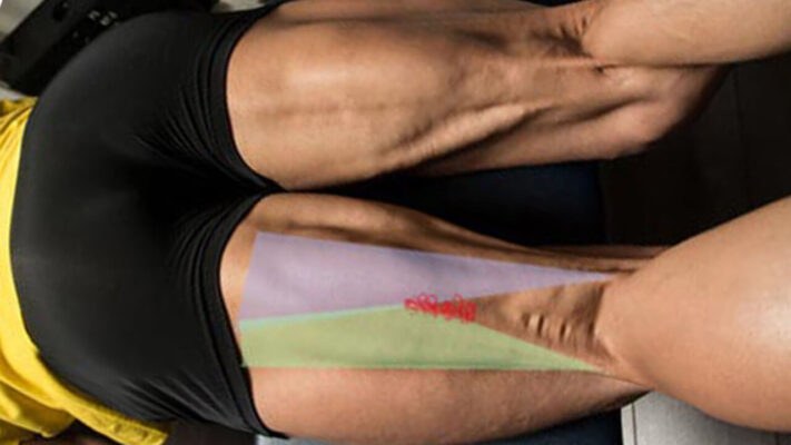 Бицепс бедра: фото.