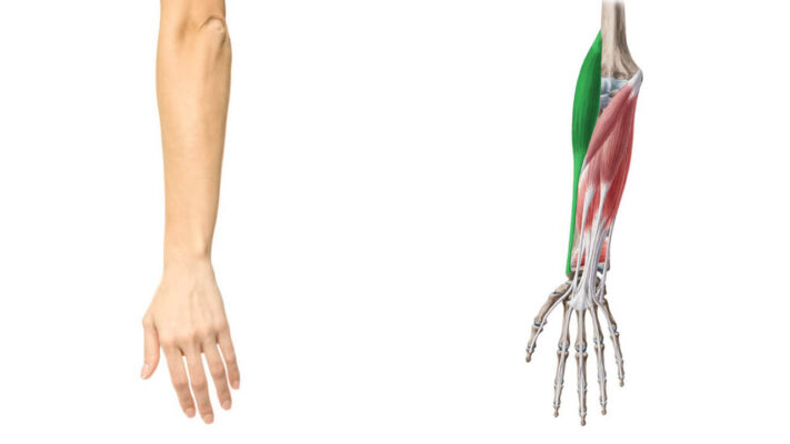 Брахиорадиалис на картинке.