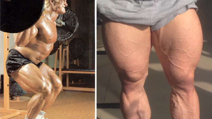 Ноги бодибилдеров: фото.