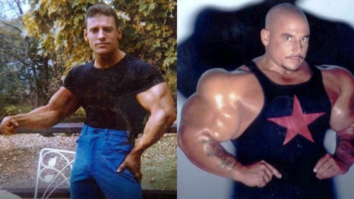 Грег Валентино: фото до и после