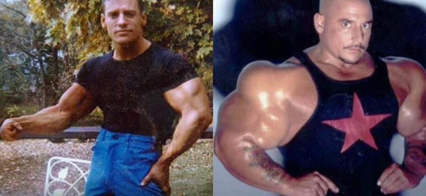 Грег Валентино: фото до и после