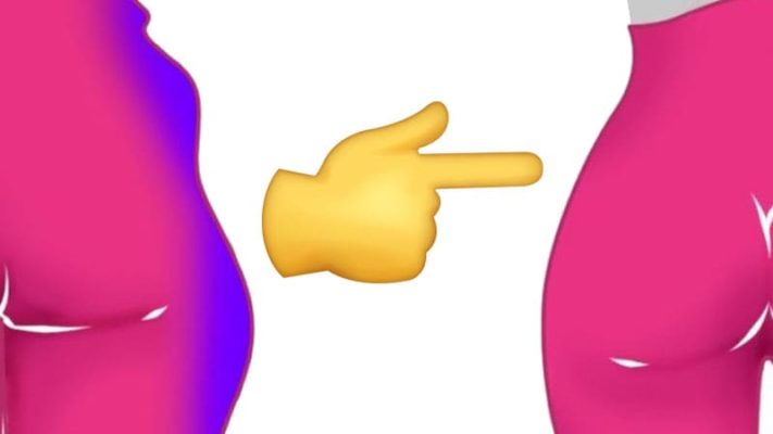 Как убрать галифе: фото.