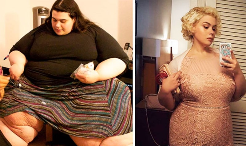 До и после похудения1: фото.