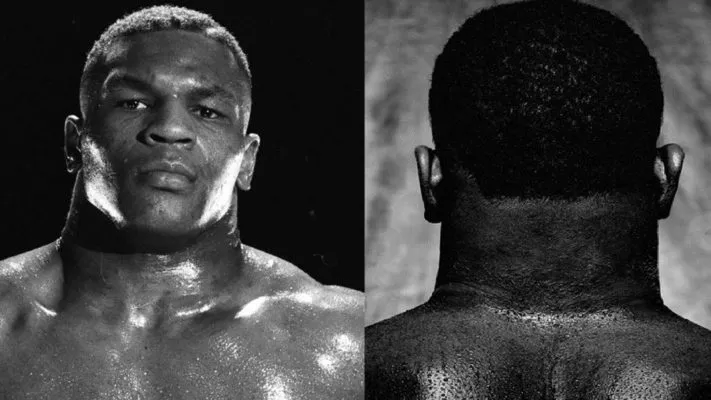 Шея Тайсона: фото.