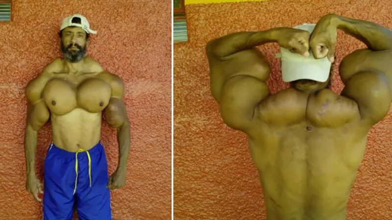 Валдир Сегато: фото.