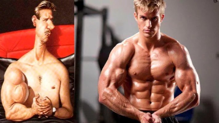 Дисбаланс мышц: фото.