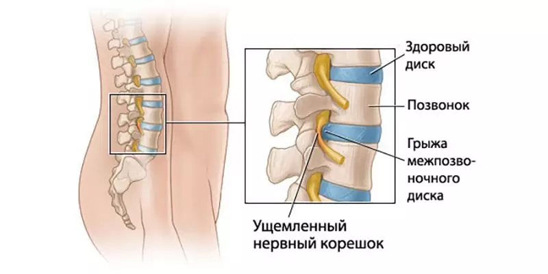 Смотреть видео с техникой выполнения